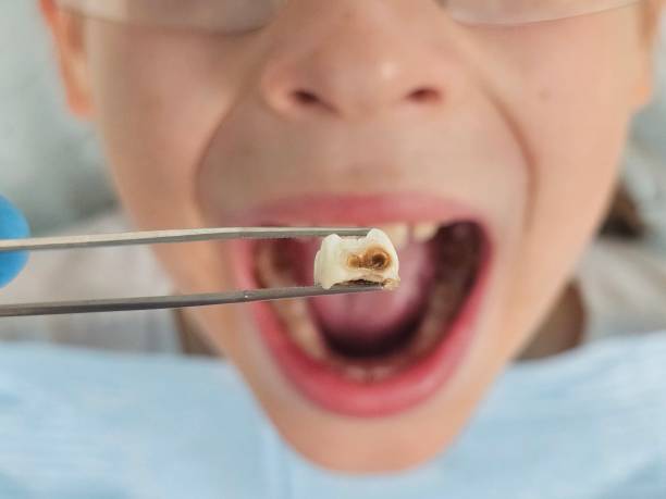 Best Emergency Treatment for Toothache in Pine Ridge At Crestwood, NJ